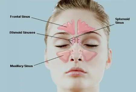 آناتومی بینی و سینوسها تخلیه سینوس در خانه, باز کردن شیپور استاش