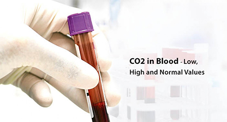 مقادیر نرمال آزمایش CO2, تفسیر آزمایش CO2, شرایط انجام آزمایش CO2