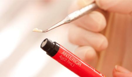 راههای درمان عوارض کامپوزیت دندان راههای درمان عوارض کامپوزیت دندان