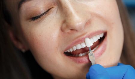 عوارض و مضرات کامپوزیت دندان عوارض و مضرات کامپوزیت دندان