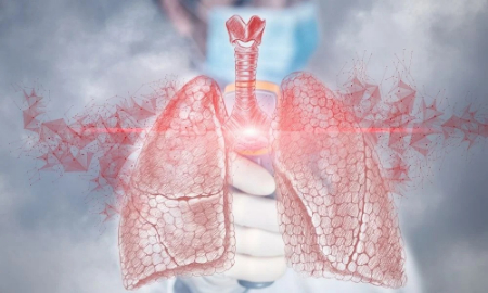 ناهنجاریهای مادرزادی ریه در دوران جنینی شکل میگیرند ناهنجاری مادرزادی ریه, ناهنجاری مادرزادی ریه در بزرگسالان