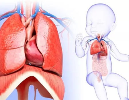 آمفیزم لوبار مادرزادی اغلب در لوب فوقانی چپ دیده میشود ناهنجاری مادرزادی ریه, ناهنجاری مادرزادی ریه در بزرگسالان