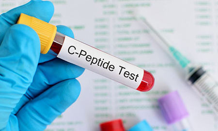 C peptide چیست, کاربرد های آزمایش سی پپتید, عوارض انجام آزمایش C-Peptide