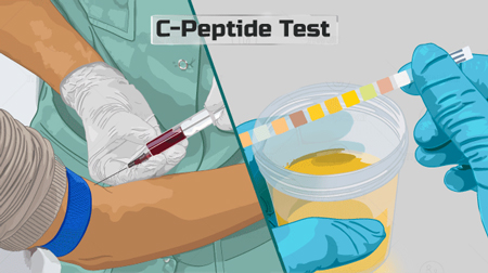 تست پپتید سی, آزمایش C-Peptide, C-Peptide در آزمایش خون