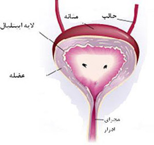 التهاب مثانه, درمان التهاب مثانه,مثانه