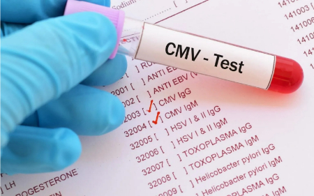 آزمایش cmv, تفسیر آزمایش MCV