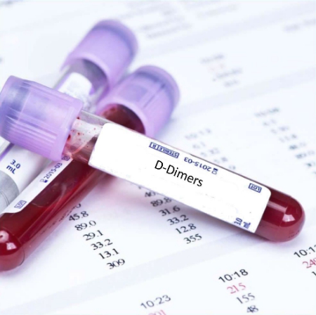 آزمایش d-dimer, جواب آزمایش d-dimer