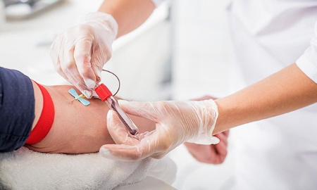 آزمایش d-dimer, جواب آزمایش d-dimer