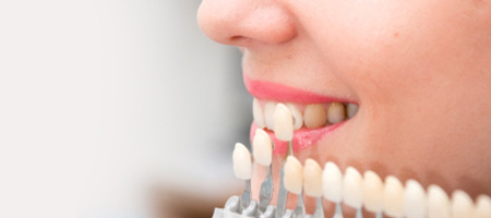  مراحل نصب لومینیرز, تفاوت لومینیرز و ونیر, مزایای لومینیرز دندان