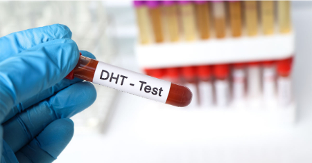 آزمایش dht, آزمایش dht برای چیست