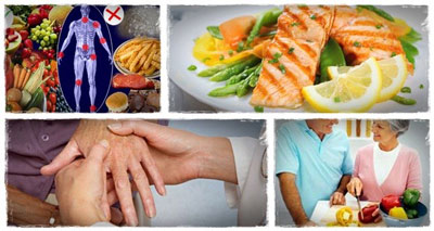 درمان آرتروز با تغذیه, مواد غذایی مفید برای آرتروز