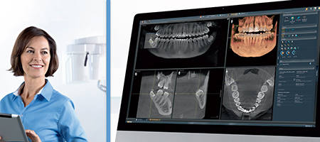 هزینه ایمپلنت دیجیتال دندان, عوارض ایمپلنت دیجیتال دندان, ایمپلنت دندان با تکنیک دیجیتال