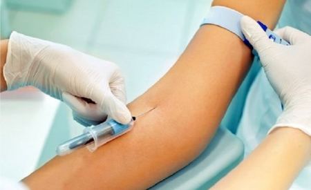 آیا ESR بالا خطرناک است آیا ESR بالا خطرناک است