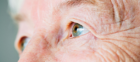 کوچک شدن ناگهانی چشم, کوچک شدن چشم در اثر بوتاکس, کوچک شدن چشم ها با افزایش سن