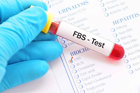 تفسیر آزمایش FBS, آزمایش FBS چیست, نوع نمونه آزمایش FBS