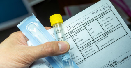 آزمایش سوزاک, آزمایش سفلیس و سوزاک