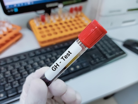 آزمایش gh,آزمایش هورمون رشد