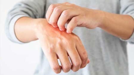 حساسیت پوستی به مواد شوینده