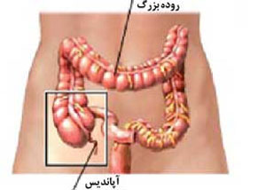 بیماریها, کشاله ران, آپاندیسیت