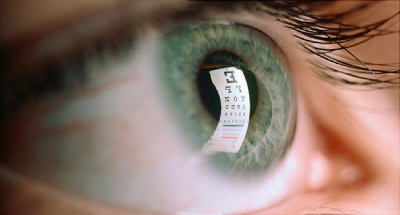 عوارض عمل لیزیک چشم ,عمل لیزیک چشم 