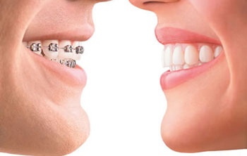 ارتودنسی, موقعیت طبیعی دندان‌ها, درمان‌های ارتودنسی