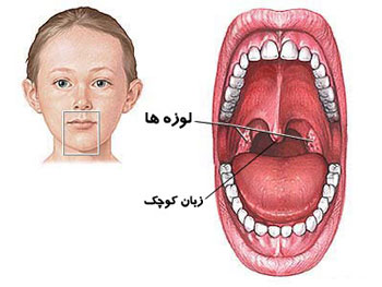 غذاهای آلرژی زا, تنگی‌نفس