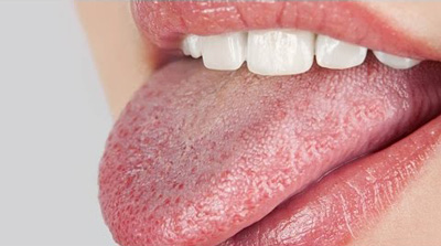 روش هایی برای درمان خشکی دهان, عوارض خشکی دهان