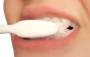 انواع سفیدكننده‌های دندان