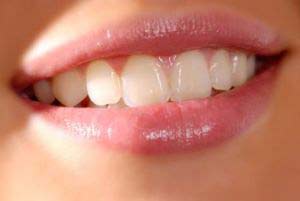 لق شدن دندان ها, پلاک دندان, پارادونت, بیماریهای دهان و دندان