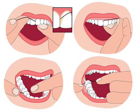 طرز استفاده از نخ دندان, استفاده از نخ دندان