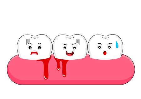 قطع خونریزی دندان کشیده شده, بند اوردن خونریزی دندان کشیده شده, بندآوردن فوری خونریزی دندان عقل