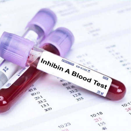آزمایش Inhibin A, هورمون اینهیبین A