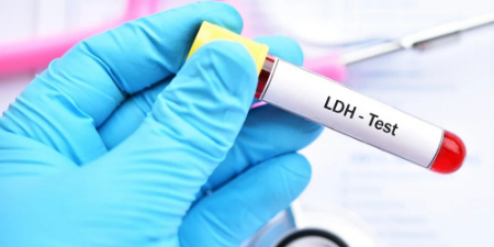 آزمایش LDH چیست, آزمایش LDH و سرطان 