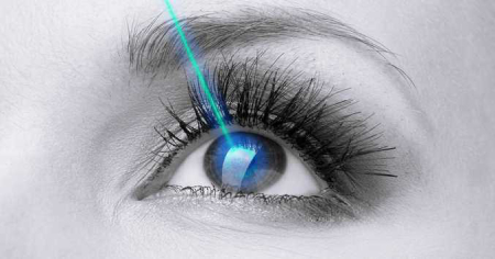 عوارض عمل لیزیک چشم ,عمل لیزیک چشم 
