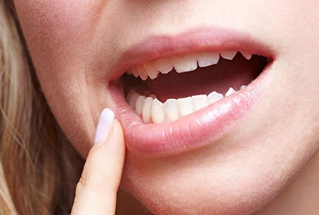 سرطان لب, علائم اولیه سرطان لب, سرطان لب نوعی سرطان دهان است