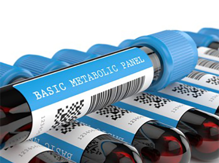 پانل پایه متابولیک bmp, تست پانل متابولیک پایه, آزمایش پنل شیمی