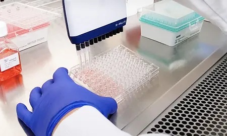 مونوسیت (Monocyte) در آزمایش خون, مونوسیت, تفسیر مونوسیت در ازمایش