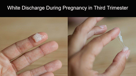ترشحات بارداری قبل از پریود,ترشحات سفید واژن قبل از پریودی,ترشحات قبل از قاعدگی