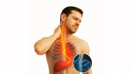 ارتباط گردن درد و کبد چرب, درمان گردن درد