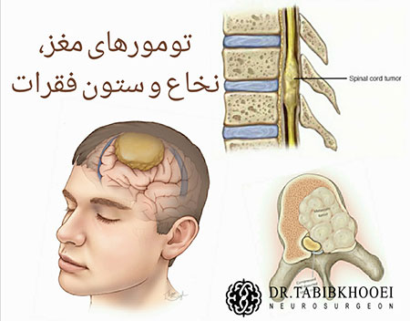جراحی مغز و اعصاب، جراح مغز و اعصاب در ایران