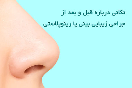 جراحی زیبایی بینی جراحی زیبایی بینی,رینوپلاستی,روشهای عمل جراحی زیبایی بینی
