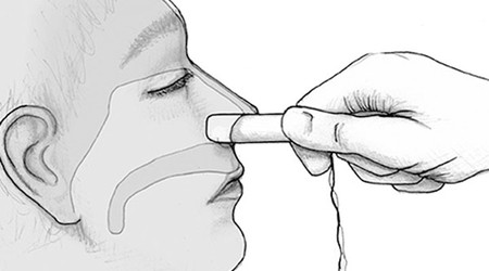 عوارض استفاده از تامپون بینی, تامپون بینی چیست, تامپون بینی