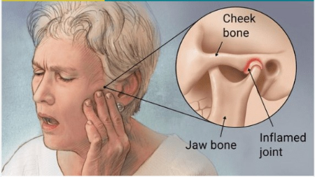 آرتروز فک؛ درد و سفتی که زندگی شما را مختل می کند
