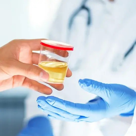 آزمایش پورفیرین, پورفیرین