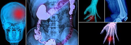 اشعه ایکس رادیولوژی, عکس دستگاه های رادیولوژی, رادیولوژی