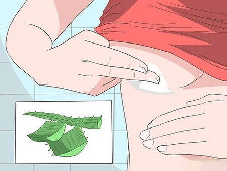عرق سوز شدن سینه ها, علت عرق سوز شدن بین سینه ها, درمان عرق سوز شدن بين سينه ها