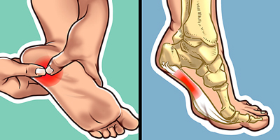 تشخیص و علل درد کف پا, درد کف پا صبحگاهی