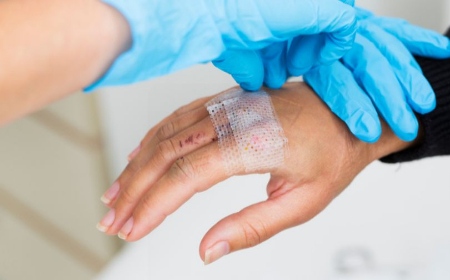 همیشه از یک گوشهی شل گاز شروع به جدا کردن کنید جدا کردن گاز استریل از زخم, استفاده از سرم برای جدا کردن گاز استریل