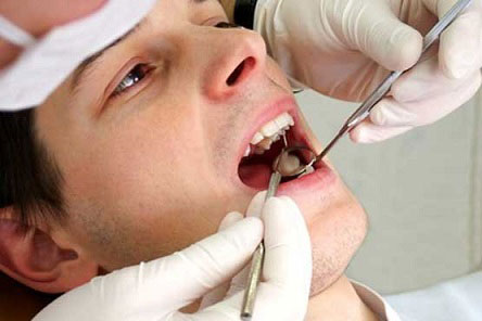  عوارض عصب کشی دندان, نحوه عصب کشی دندان