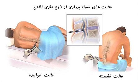 پونکسیون کمری, نمونه گیری از مایع مغزی نخاعی, مایع مغزی نخاعی